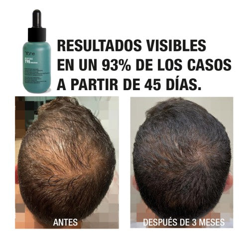 TRATAMENTO ANTI-QUEDA T98 CONCENTRADO - 50ML